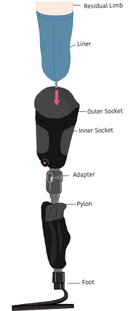 Figure. Schematic view of lower limb prosthesis